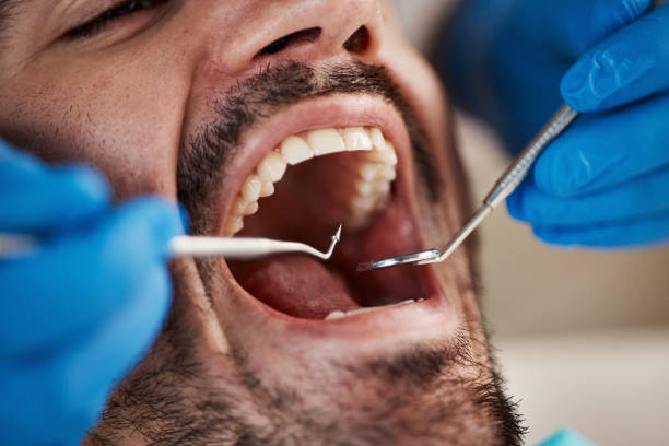 Best Emergency Treatment for Oral Infections in Bushyhead, OK